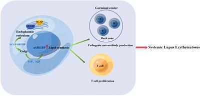 Research progress of SREBP and its role in the pathogenesis of autoimmune rheumatic diseases